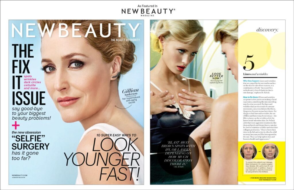 Dr. Motykie&#8217;s Sun Damage Correction Before &#038; After Photos in New Beauty Magazine