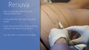 Renuva Skin Care Treatment Cost Beverly Hills | Los Angeles CA