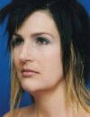 Neck Liposuction case #4930