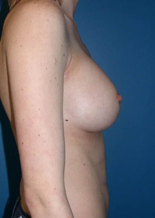 Procedure case #3840
