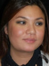 Buccal Fat Removal case #4137