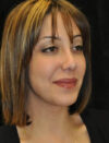 Facial Fat Grafting case #4549