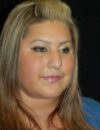 Neck Liposuction case #4997