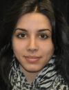 Facial Fat Grafting case #4593
