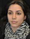 Facial Fat Grafting case #4593