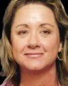 Blepharoplasty case #3524