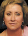 Blepharoplasty case #3524