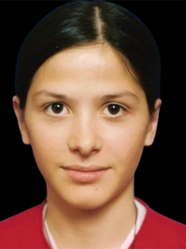 Otoplasty case #5002