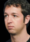 Chin Implant case #4186