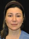 Lower Blepharoplasty case #3439