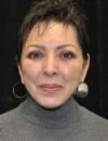 Blepharoplasty case #3493