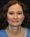 Blepharoplasty case #3504
