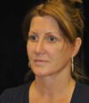 Lower Blepharoplasty case #3417