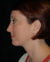 Profile Balancing case #12706