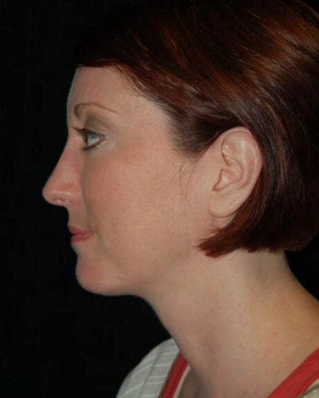 Profile Balancing case #12706