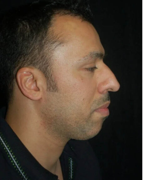 Profile Balancing case #12717