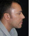 Profile Balancing case #12717