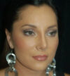 Rhinoplasty case #12782