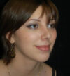 Rhinoplasty case #12878