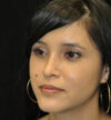 Rhinoplasty case #12917