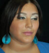 Rhinoplasty case #13170