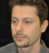 Rhinoplasty case #13366
