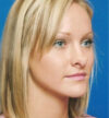 Rhinoplasty case #13103