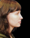 Profile Balancing case #12730