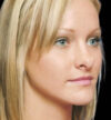 Rhinoplasty case #13103