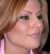 Rhinoplasty case #12808