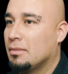 Rhinoplasty case #12803