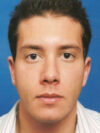 Otoplasty case #13867
