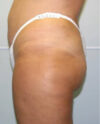 JuvaShape case #13883