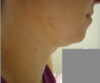 JuvaShape case #13886