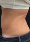 JuvaShape case #13870