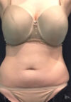 JuvaShape case #13870