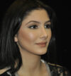 Rhinoplasty case #15333