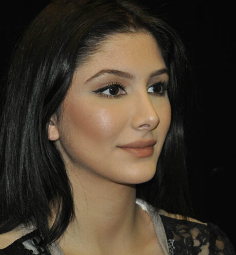 Rhinoplasty case #15333