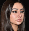 Rhinoplasty case #15304
