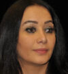 Rhinoplasty case #15254
