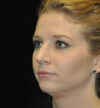 Rhinoplasty case #15195